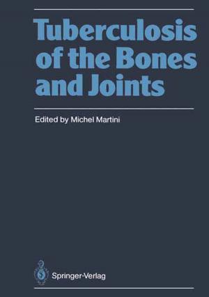 Cover of the book Tuberculosis of the Bones and Joints by Bernd Bilitewski, Georg Härdtle