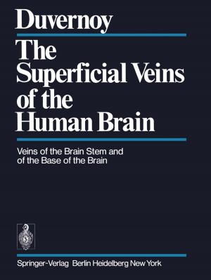 Cover of the book The Superficial Veins of the Human Brain by John B. Kyalo Kiema, Joseph L. Awange
