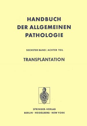 Cover of the book Transplantation by Bernhard Weigand, Jürgen Köhler, Jens Wolfersdorf