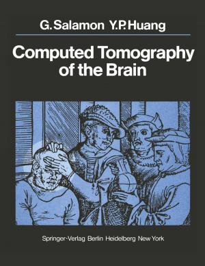 Cover of the book Computed Tomography of the Brain by Marco Meier, Werner Sinzig, Peter Mertens