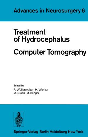 Cover of the book Treatment of Hydrocephalus Computer Tomography by Xiaofeng Meng, Zhiming Ding, Jiajie Xu