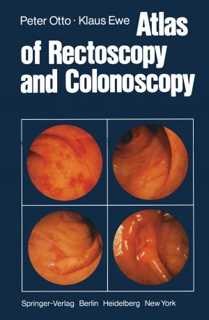 Cover of the book Atlas of Rectoscopy and Coloscopy by Gui Lu