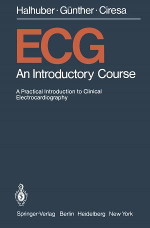 Cover of the book ECG by Yves Keravel, G. Debrun, P. Decq, Marc Sindou, F.G. Diaz, V. Dolenc, J. Duquesnel, A. Gaston, Y. Guegan, J. Huppert, C. Marsault, P. Mercier, J. Moret, F.R. Nelson, J.P. Nguyen, G. Perrin, J. Pialat
