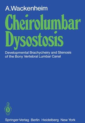 Cover of the book Cheirolumbar Dysostosis by George Jaiani