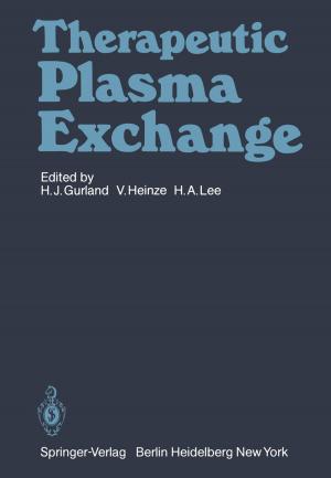 Cover of the book Therapeutic Plasma Exchange by Jean M. Rüeger