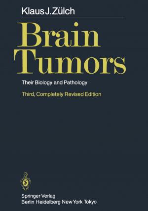 Cover of the book Brain Tumors by Annika Melles