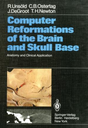 Cover of the book Computer Reformations of the Brain and Skull Base by Gilbert Brands