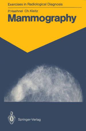 Cover of the book Mammography by Rongxing Guo, Luc Changlei Guo, Hao Gui