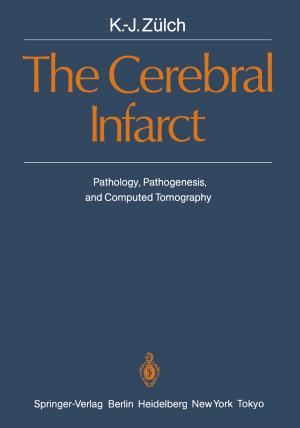 Cover of the book The Cerebral Infarct by Yves Keravel, G. Debrun, P. Decq, Marc Sindou, F.G. Diaz, V. Dolenc, J. Duquesnel, A. Gaston, Y. Guegan, J. Huppert, C. Marsault, P. Mercier, J. Moret, F.R. Nelson, J.P. Nguyen, G. Perrin, J. Pialat