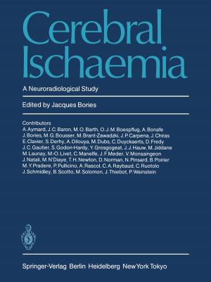 Cover of the book Cerebral Ischaemia by Chiara Buratti, Marco Martalo', Roberto Verdone, Gianluigi Ferrari