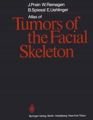 Cover of the book Atlas of Tumors of the Facial Skeleton by Hans-Peter Braun, Martin Reents, Peter Zahn, Patrick Wenzel