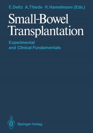 Cover of the book Small-Bowel Transplantation by Dr. Joel Berman