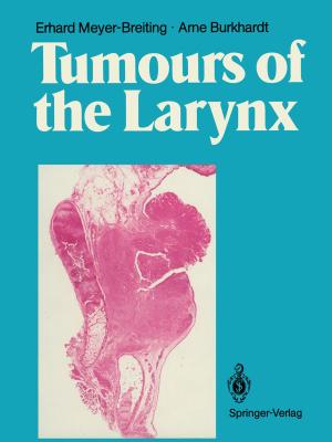 Cover of the book Tumours of the Larynx by J. Paul Elhorst