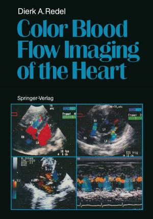 Cover of the book Color Blood Flow Imaging of the Heart by 