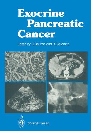 Cover of the book Exocrine Pancreatic Cancer by Ulrich Gellert, Ana Daniela Cristea
