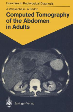 Cover of the book Computed Tomography of the Abdomen in Adults by M.P. Fleisch-Ronchetti