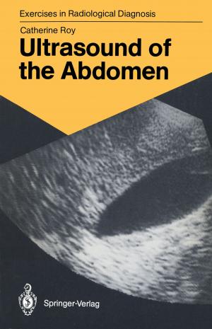 Cover of the book Ultrasound of the Abdomen by K.J. Barteczko, M.I. Jacob