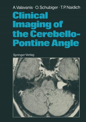 Cover of the book Clinical Imaging of the Cerebello-Pontine Angle by Stefan Tappe