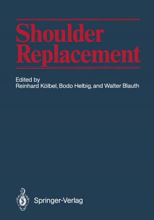 Cover of the book Shoulder Replacement by R. Ackermann, K.-D. Bachmann, H. Behrendt, P.E. Billimoria, H.C. Dominick, M.D. Gross, R. Hartung, W. Havers, R. Heckemann, J.V. Kaude, R.E. Kinard, E.K. Lang, L.-D. Leder, E. Löhr, A.A. Moss, R.-D. Müller, H.J. Richter, E. Scherer, M. Serdarevic, B. Shapiro, W.P. Shuman, J.L. Williams, C. Wirtz