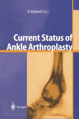 Cover of the book Current Status of Ankle Arthroplasty by Jelena Boekhoff