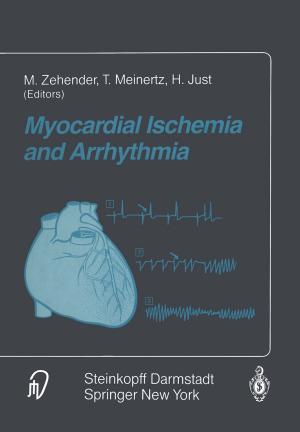 Cover of the book Myocardial Ischemia and Arrhythmia by Weber, Laczkovics, Glogar, Scheibelhofer, Steinbach
