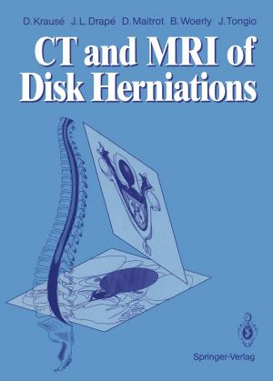 Cover of the book CT and MRI of Disk Herniations by Falk Giemsa, Jörg Machek, Alex Gardiner, Daniel Closa