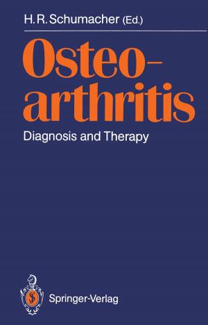 Cover of the book Osteoarthritis by Barbara Suppé, Matthias Bongartz