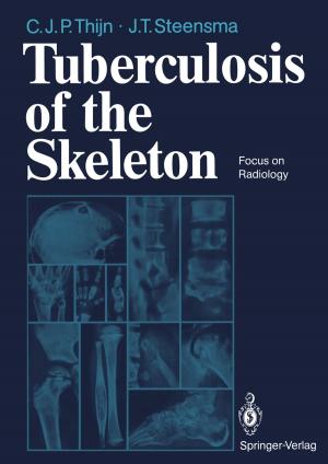 Book cover of Tuberculosis of the Skeleton