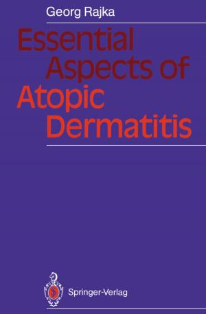 Cover of the book Essential Aspects of Atopic Dermatitis by P.B. Barraclough, N.O. Crossland, W. Mabey, C.M. Menzie, T. Mill, P.B. Tinker, M. Waldichuk, C.J.M. Wolff, R. Herrmann