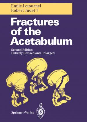 Cover of the book Fractures of the Acetabulum by R.D. de Abreu, G. van den Berghe, G. Calabrese, D.J. McCarty, B.T. Emmerson, B. Gathof, M. Gonella, U. Gresser, W. Gröbner, I. Kamilli, W. Löffler, W. Mohr, G. Nuki, D. Perrett, J.G. Puig, F. Roch-Ramel, M. Schattenkirchner, J.T. Scott, H.A. Simmonds, O. Sperling, R. Terkeltaub, R.W.E. Watts, H.F. Woods, N. Zöllner, K.L. Schmidt