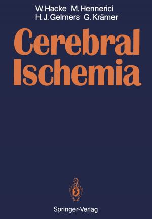 Cover of the book Cerebral Ischemia by Kyriaki Noussia