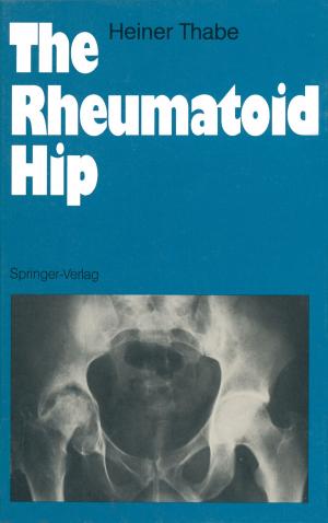 Cover of the book The Rheumatoid Hip by Tobias Schüttler