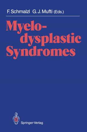Cover of the book Myelodysplastic Syndromes by Judith Eckle-Kohler, Michael Kohler