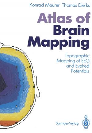 Cover of the book Atlas of Brain Mapping by Nina Konopinski-Klein, Dagmar Seitz, Joanna Konopinski