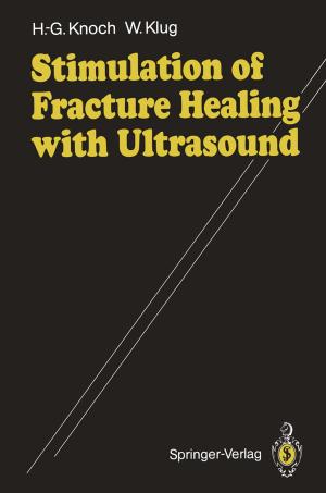 Cover of the book Stimulation of Fracture Healing with Ultrasound by Hans-Joachim Bungartz, Stefan Zimmer, Martin Buchholz, Dirk Pflüger
