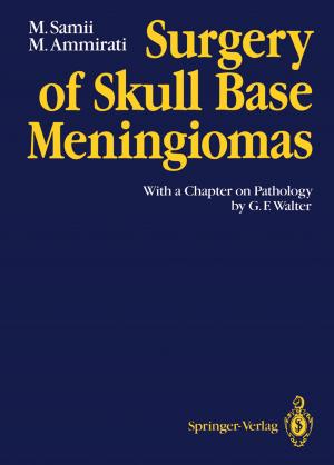Cover of the book Surgery of Skull Base Meningiomas by R. Nieuwenhuys, C. van Huijzen, J. Voogd