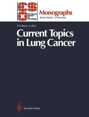 Cover of the book Current Topics in Lung Cancer by L.W. Newland, M. Zander, E. Merian, K.A. Daum, C.R. Pearson, K.J. Bock, H. Stache