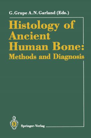 bigCover of the book Histology of Ancient Human Bone: Methods and Diagnosis by 