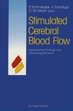 Cover of the book Stimulated Cerebral Blood Flow by Bernhard Weigand, Jürgen Köhler, Jens von Wolfersdorf
