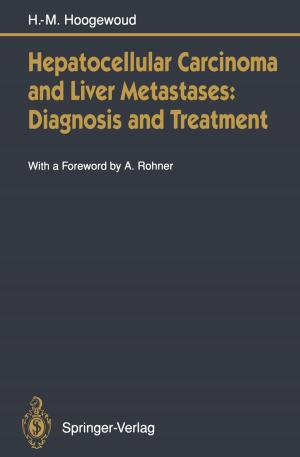 Cover of the book Hepatocellular Carcinoma and Liver Metastases: Diagnosis and Treatment by Wilhelm Waldenfels