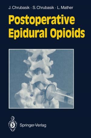 Cover of the book Postoperative Epidural Opioids by Rainer E. Zimmermann, Simon M. Wiedemann