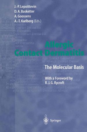 Cover of the book Allergic Contact Dermatitis by Falk Bornstaedt, Rüdiger Zarnekow, Jochen Wulf