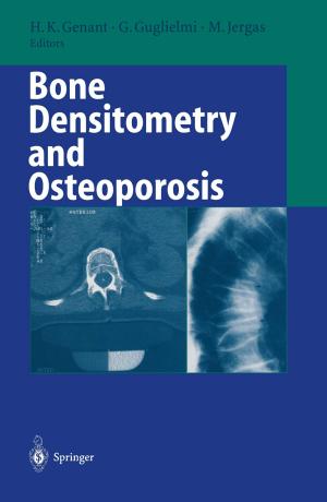 Cover of the book Bone Densitometry and Osteoporosis by Christian Kern, Eva Schubert, Marianne Pohl