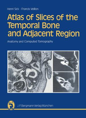 Cover of Atlas of Slices of the Temporal Bone and Adjacent Region