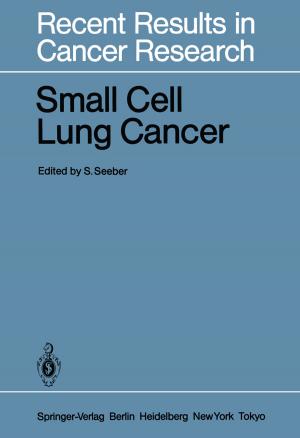 Cover of the book Small Cell Lung Cancer by G. Julius Vancso, Holger Schönherr