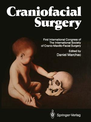 Cover of the book Craniofacial Surgery by Stephan Frings, Frank Möhrlen, Werner A. Müller