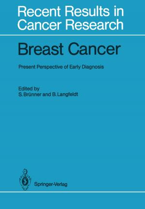 Cover of the book Breast Cancer by Klaus-Dieter Hupke
