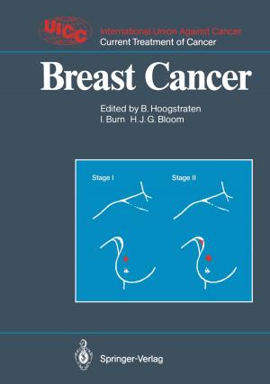 Cover of the book Breast Cancer by Asahiko Taira, Timothy Byrne, Juichiro Ashi