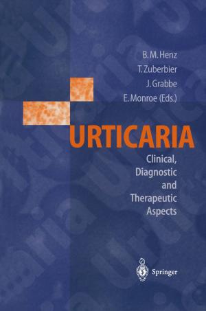 Cover of the book Urticaria by Paul M. Selzer, Richard J. Marhöfer, Oliver Koch