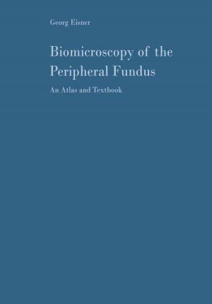 Cover of the book Biomicroscopy of the Peripheral Fundus by Ralf Lindau